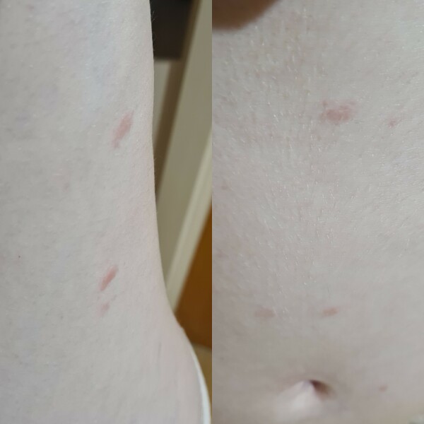 Strange red blotches
