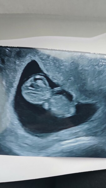 Due February 2025 - Thread 2