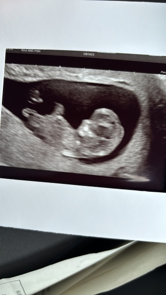 worried from scan photo