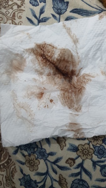 Warning pic attached!! Implantation bleeding?