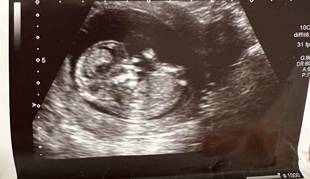 Boy or Girl 💙🩷