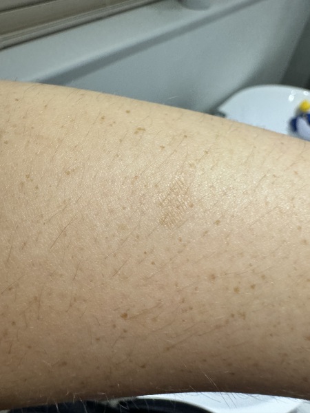 Dry skin patch
