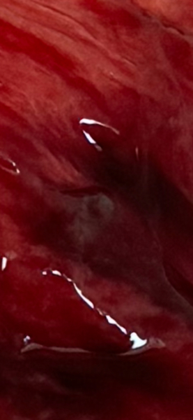 *TM could this be the baby?