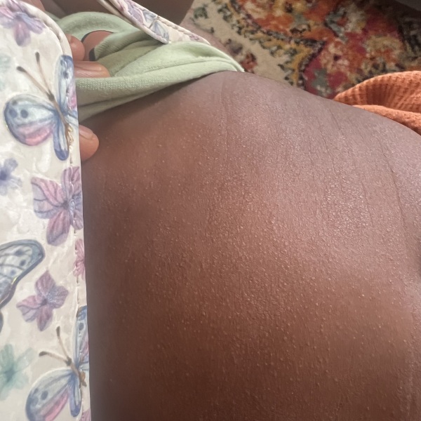 Baby skin