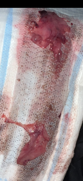 Just looking for advice