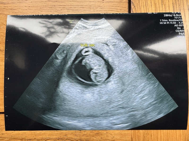 BFP after recent loss