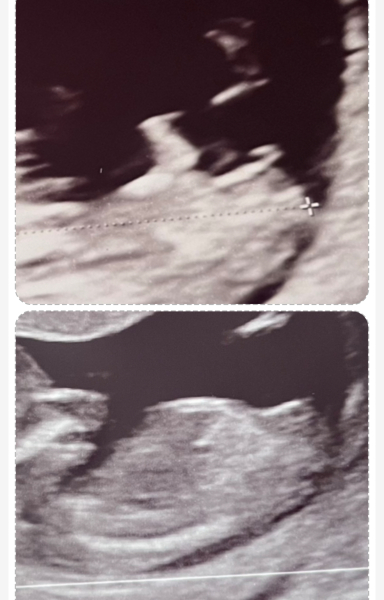Nub angle has changed within a week!