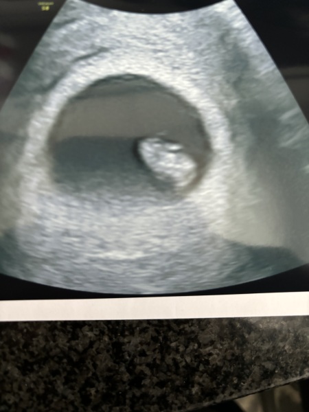 Due February 2025 - Thread 2