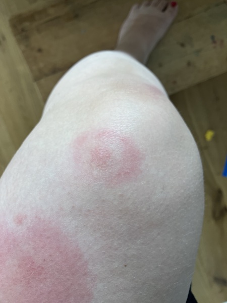 Bullseye bites?
