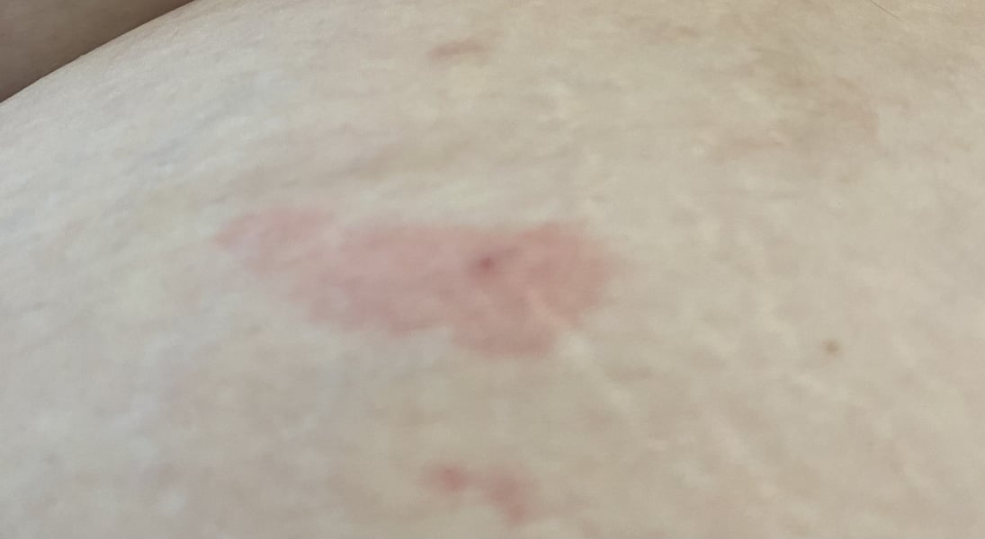 Continuing Mounjaro...part 15