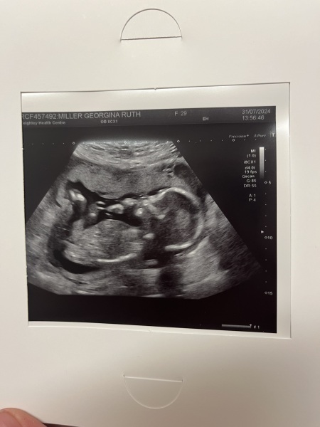 Gender guess!