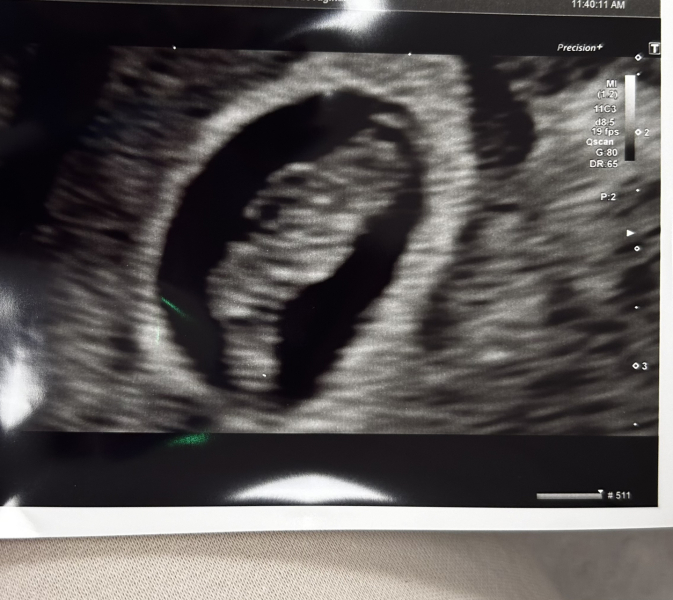 BFP after recent loss