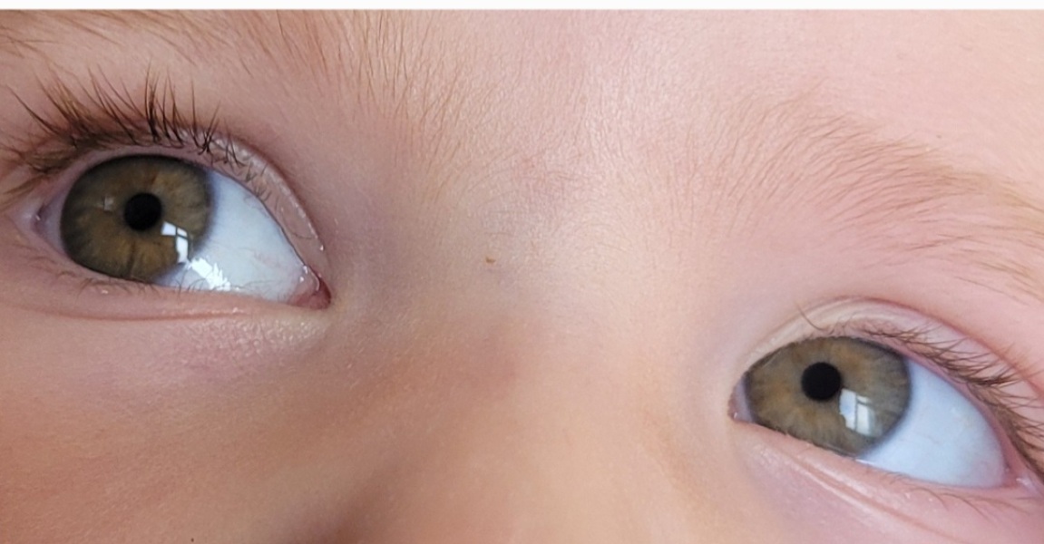 Eye colour - help