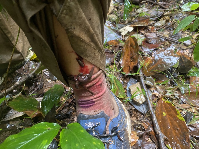 Attacked by Leeches- TMI Photos