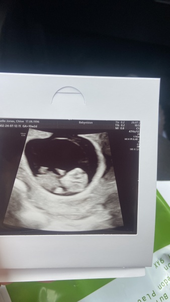 BFP after recent loss (Thread 2) 🌈