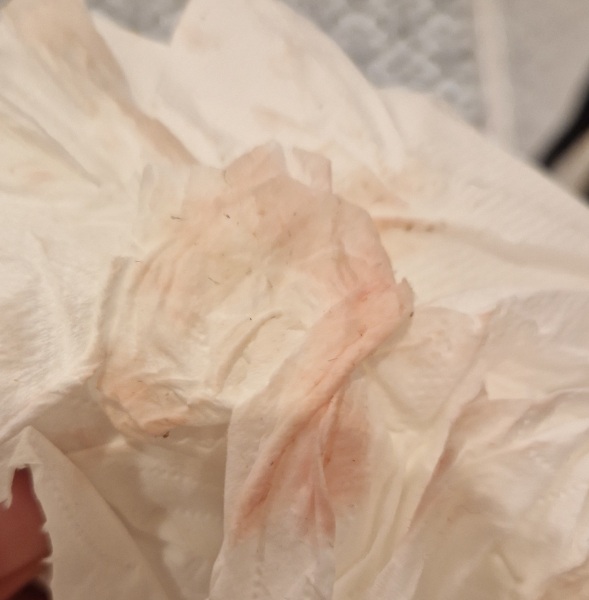 Implantation or AF coming?