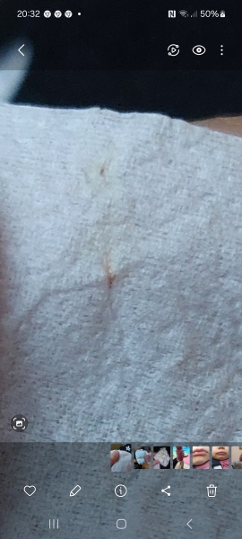 Red spotting - worried - *PICTURE INCLUDED*