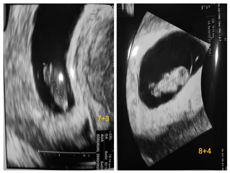 Experience with reading ultrasounds?