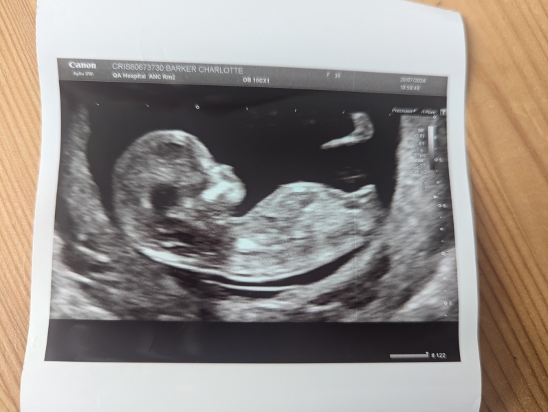 Due February 2025 - Thread 2