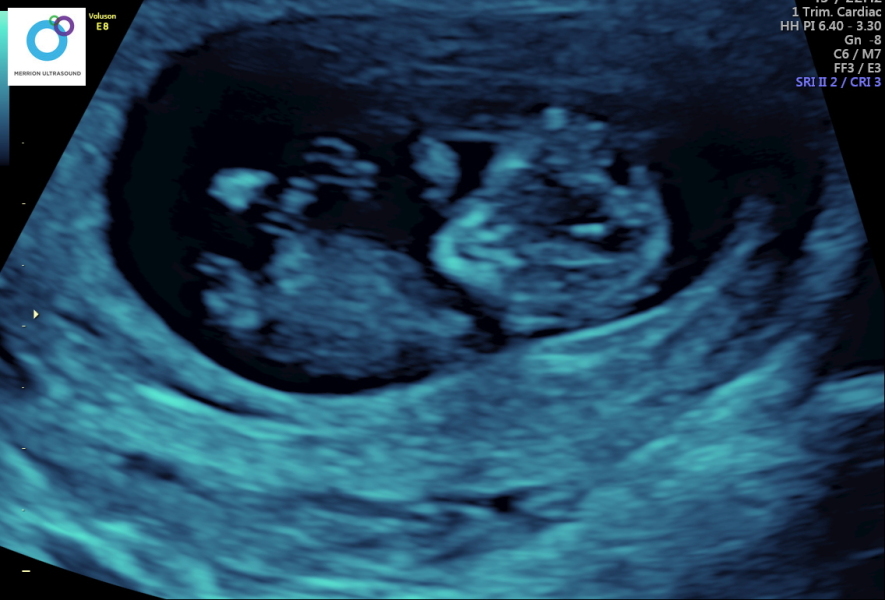 Due February 2025 - Thread 2