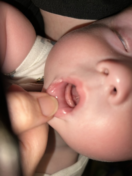 Underneath of tongue