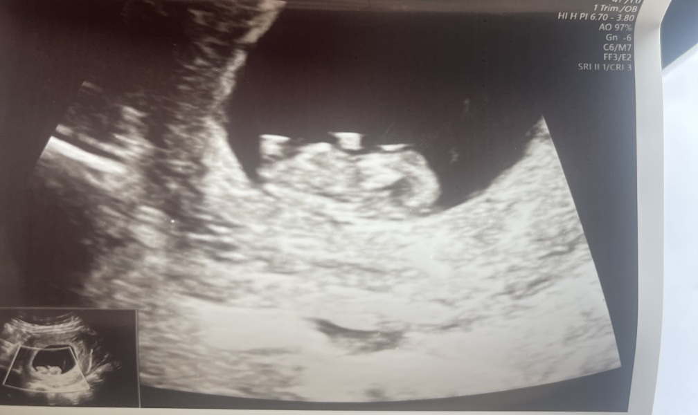 Nub theory - 9 weeks