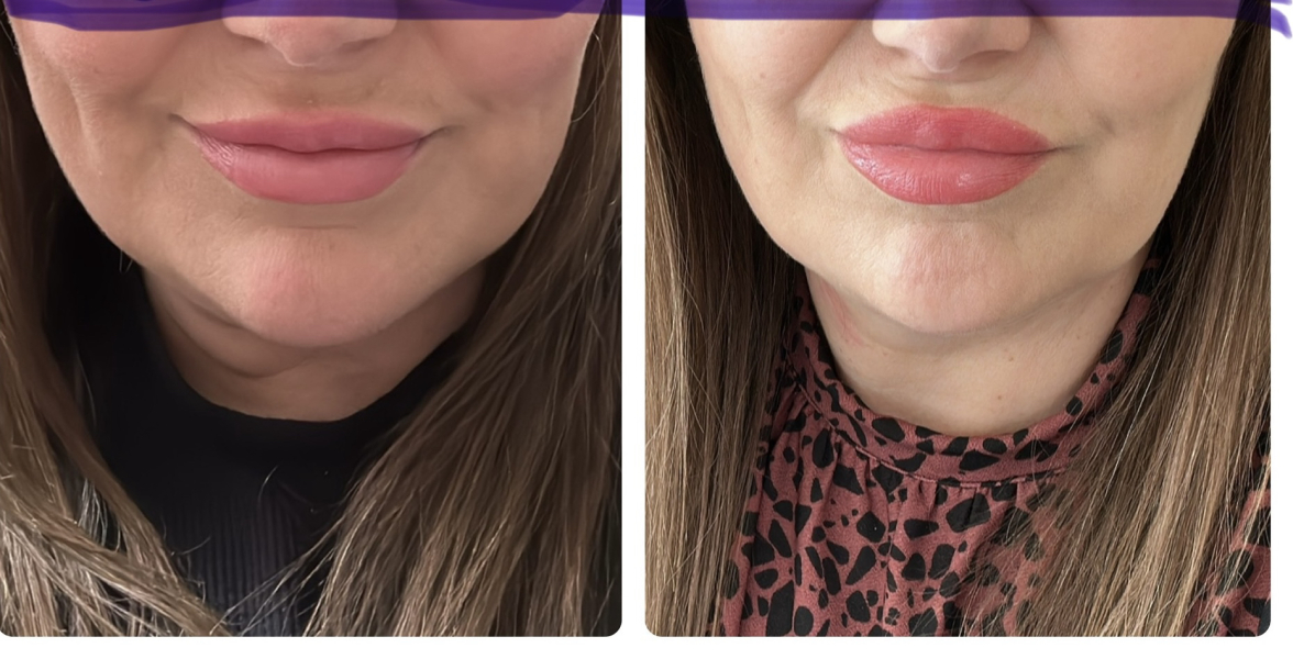 Just wanted to share my almost 3 month progress on MJ - pic