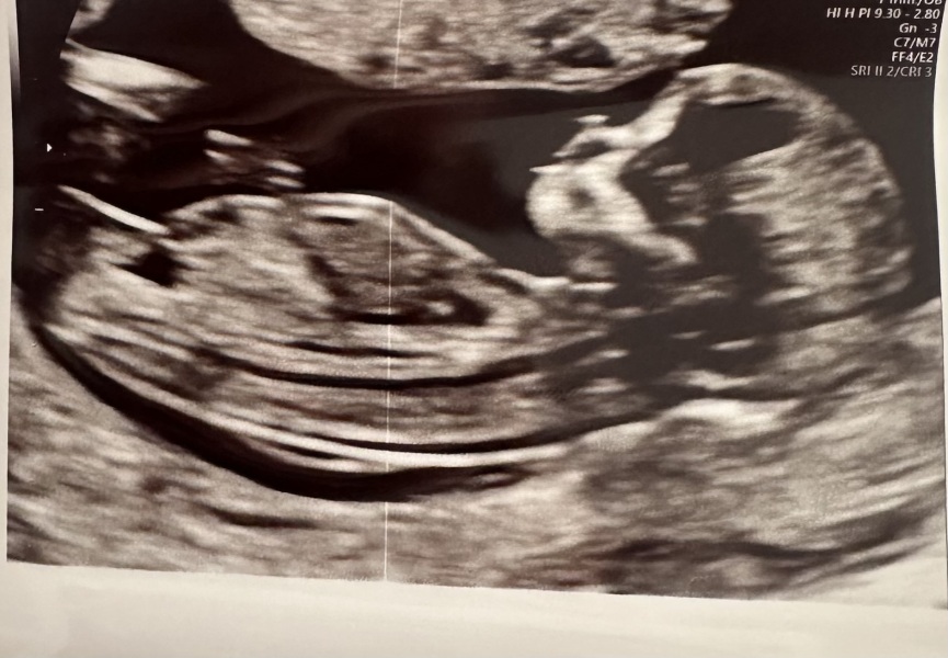 Girl or Boy?