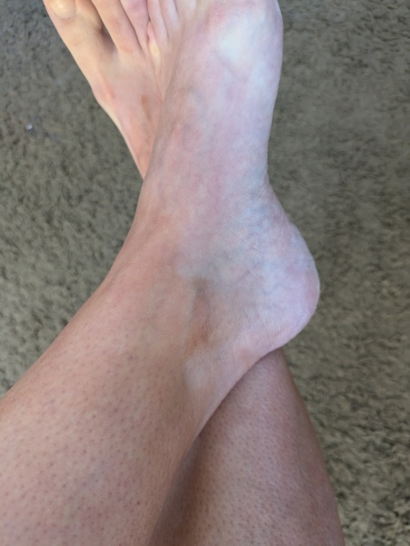 Aldi gradual tan - a warning and help please!