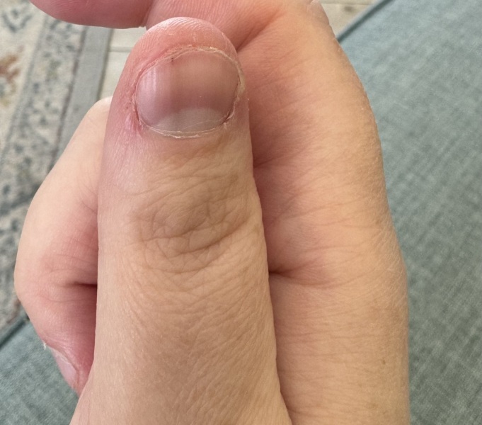 Dark line down thumbnail