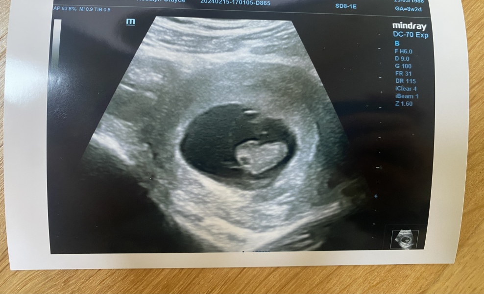 BFP after recent loss