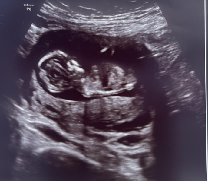 12 week Gender guess for fun 💙🩷