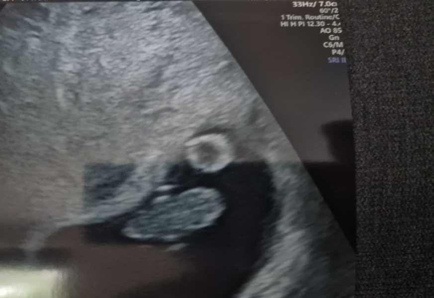 Due February 2025 - Thread 2
