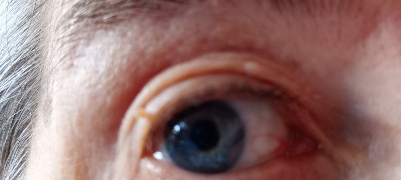 Settle an eye colour debate for me please?