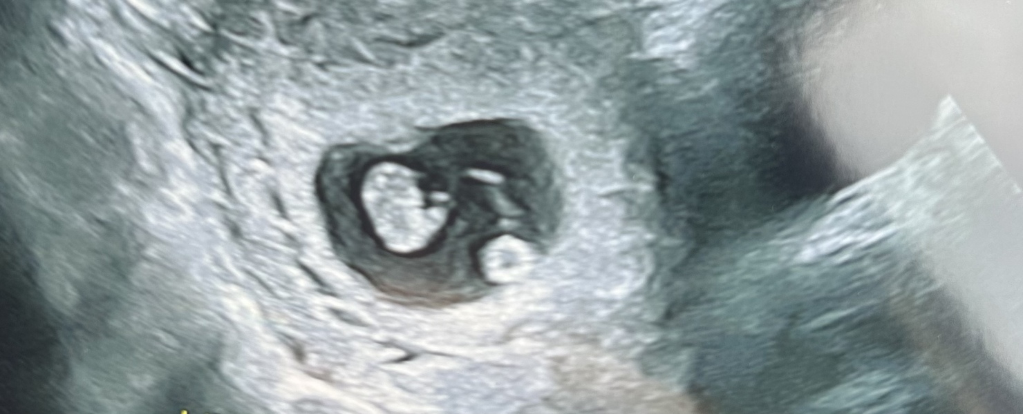 Due February 2025 - Thread 2