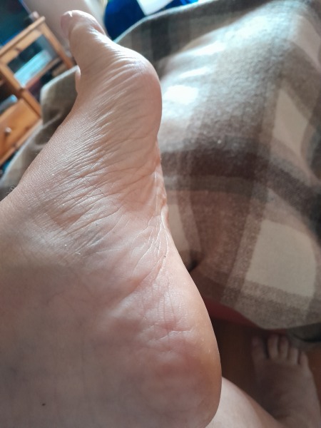 Best way to remove dead skin/keep feet smooth?