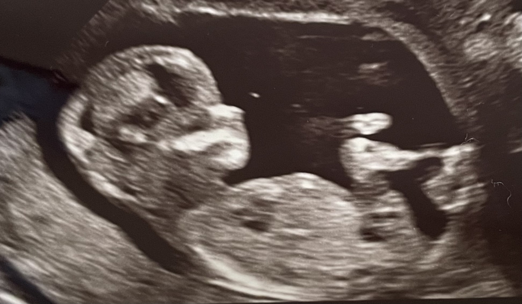 BFP after IVF - anyone want to join me in the wait for first scan?