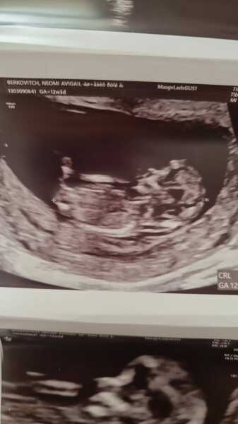 Has anyone been told the gender at 12 week scan?