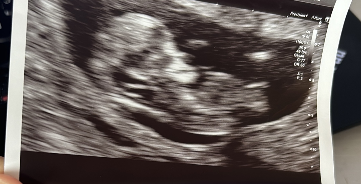 Nub - boy or girl?