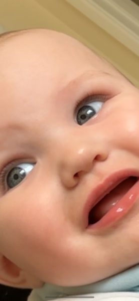 Eyes