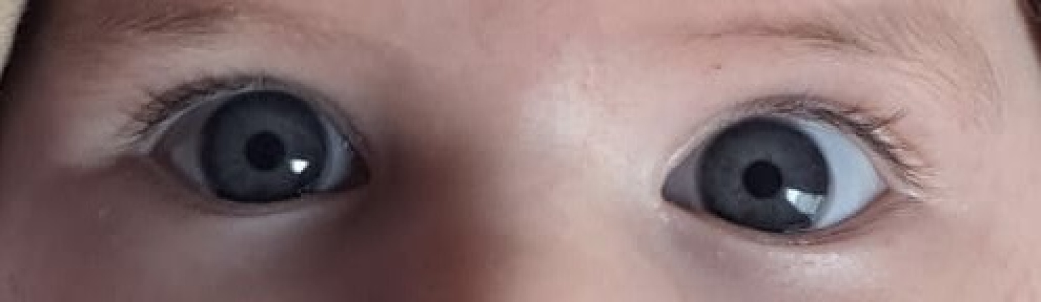 Eye colour prediction