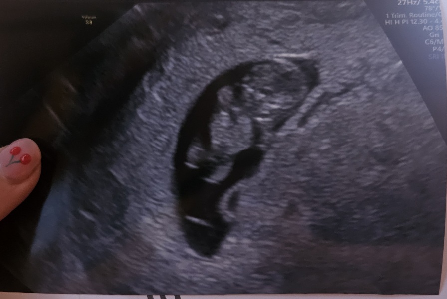 Due February 2025 - Thread 2