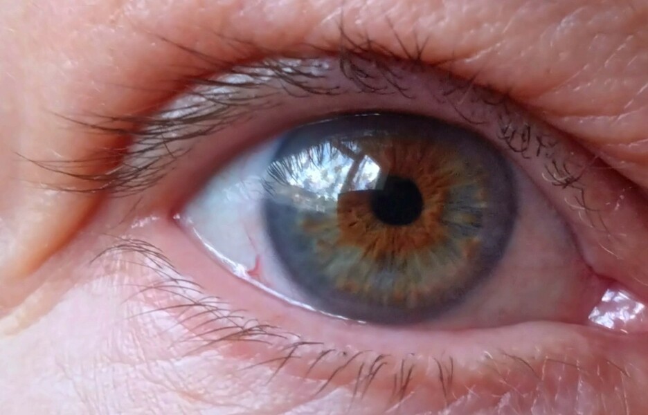 Eye colour