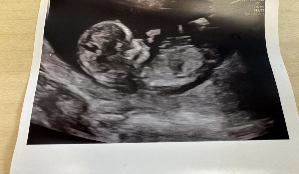 Guess baby’s gender from 12 week scan pic? Just for fun!