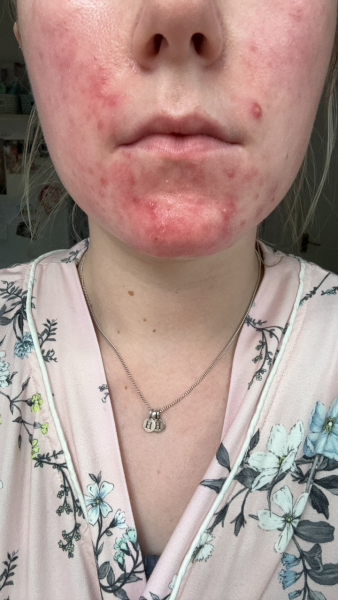 Why does my makeup do this??