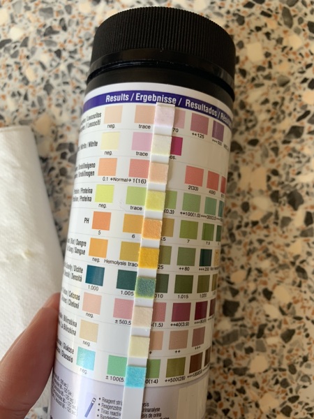 Urine dip stick test