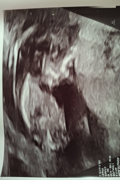 Nub guesses please. Would you trust early glimpse?
