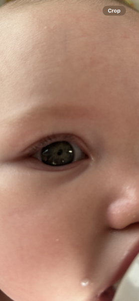 Eyes