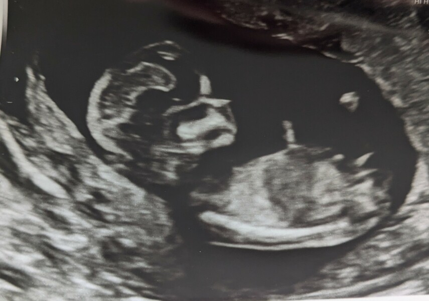 Boy or girl?