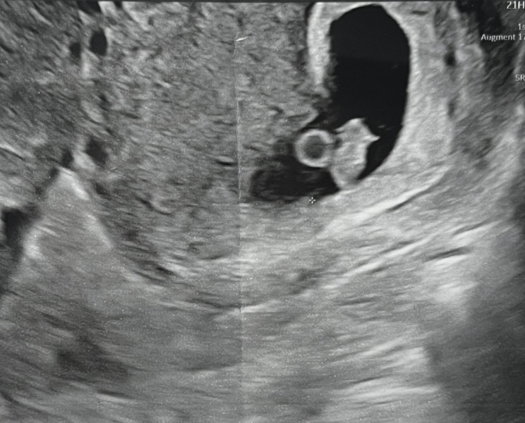 First Timers TTC. Safe space for brain dumps, questions, whinges and celebrations. Part 2!